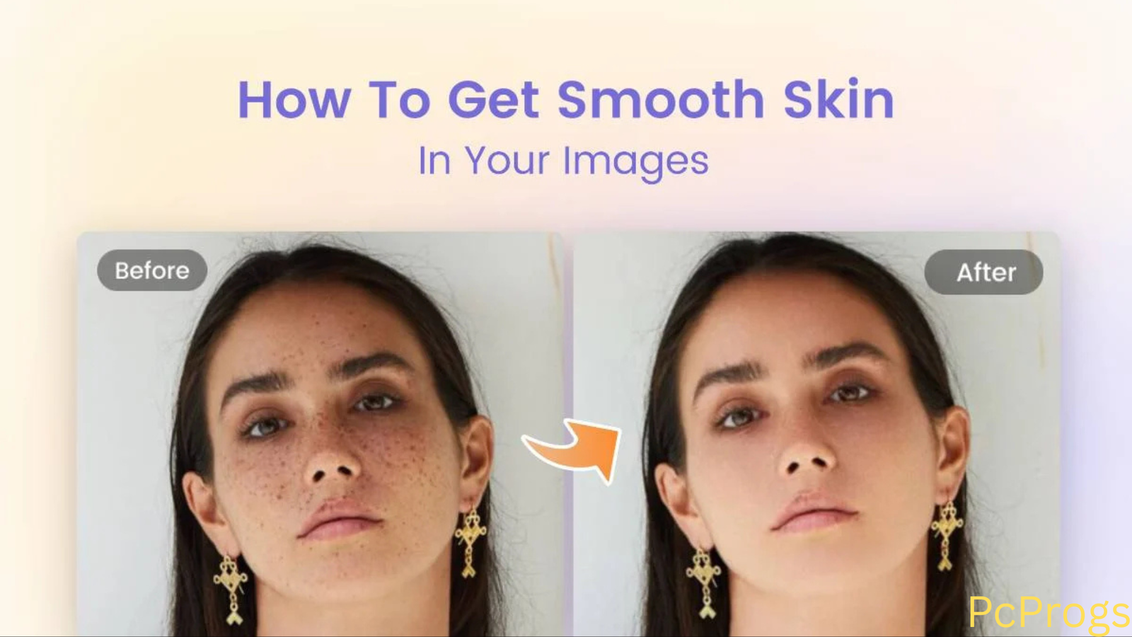 SkinFiner